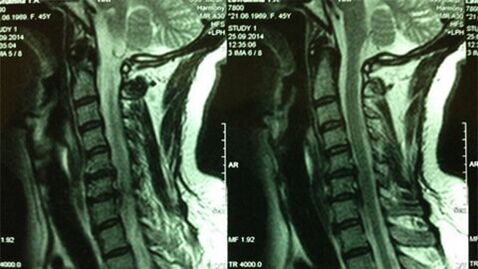MRI Odjela za cervikalno odjeljenje