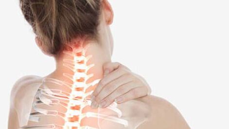 Osteohondroza grlića maternice