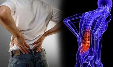 Razlozi razvoja lumbalne osteohondroze