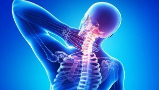 kako se manifestira osteohondroza