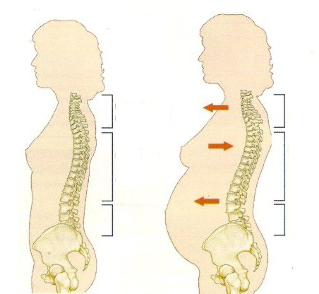 osteohondroza tijekom trudnoće