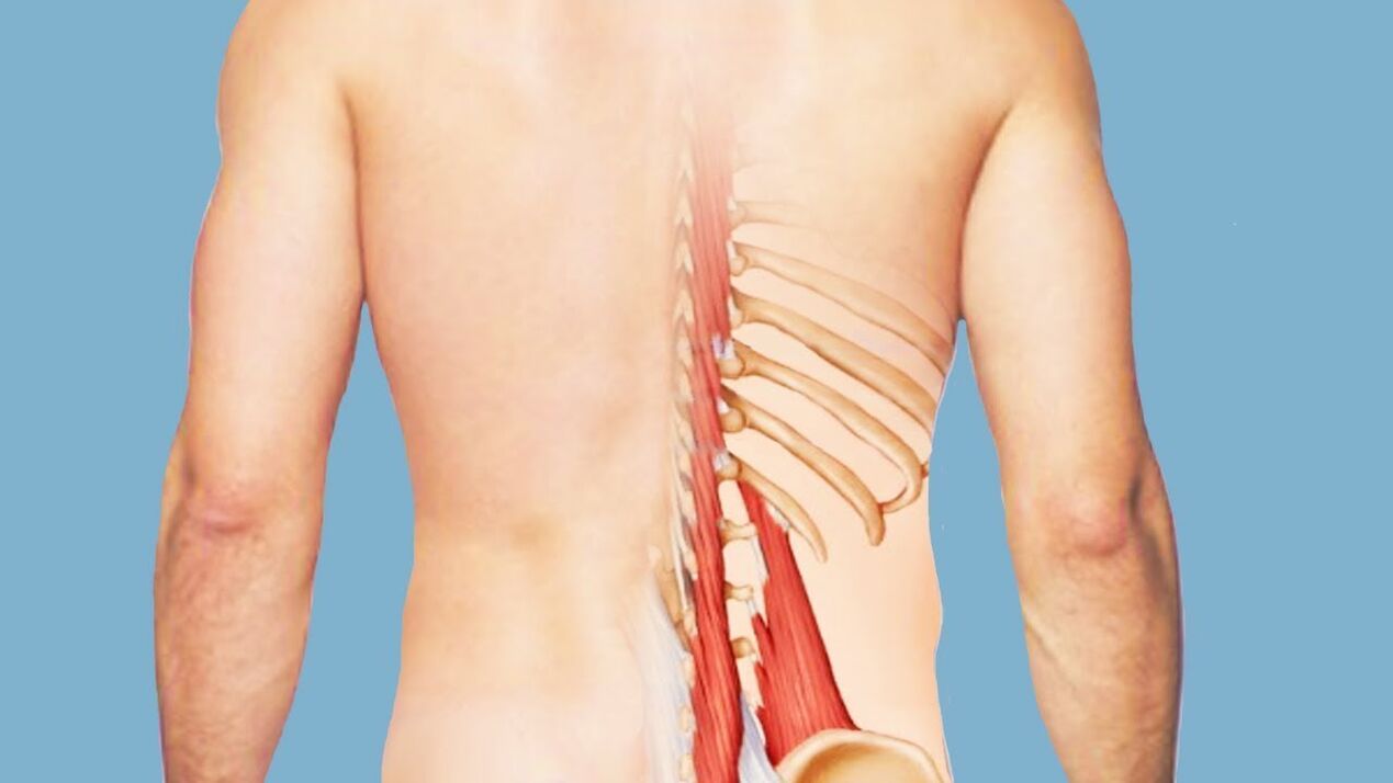 miozitis kao uzrok bolova u leđima
