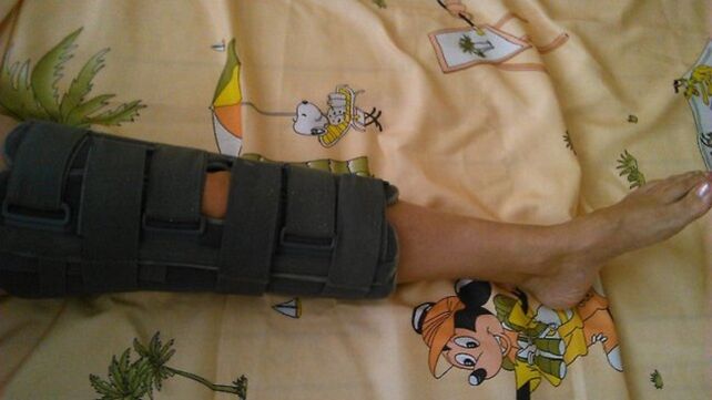 imobilizacija zgloba koljena zbog bolova